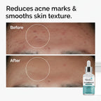 Niacinamide Serum