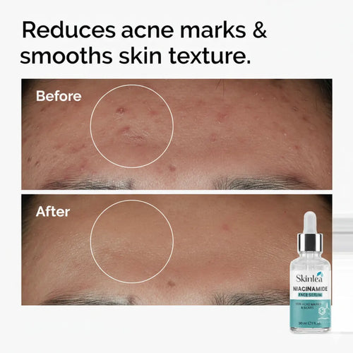 Niacinamide Serum