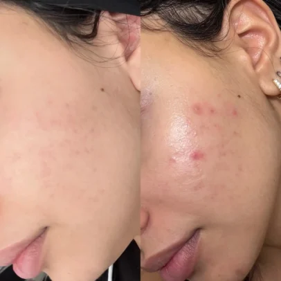 Before and after