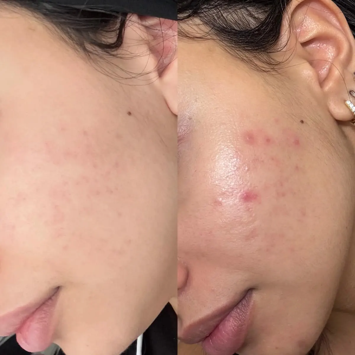 Before and after