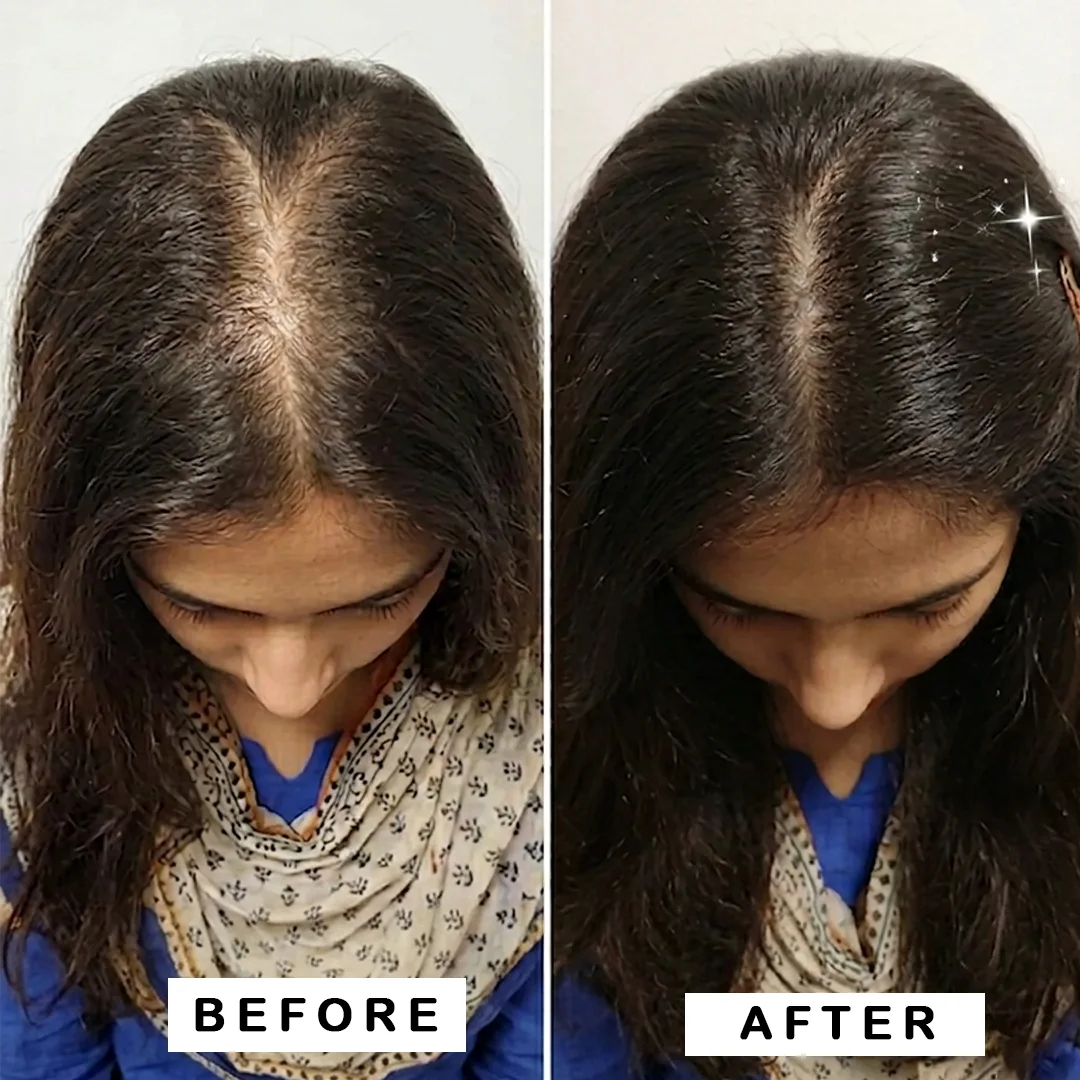 Before and after hair growth result