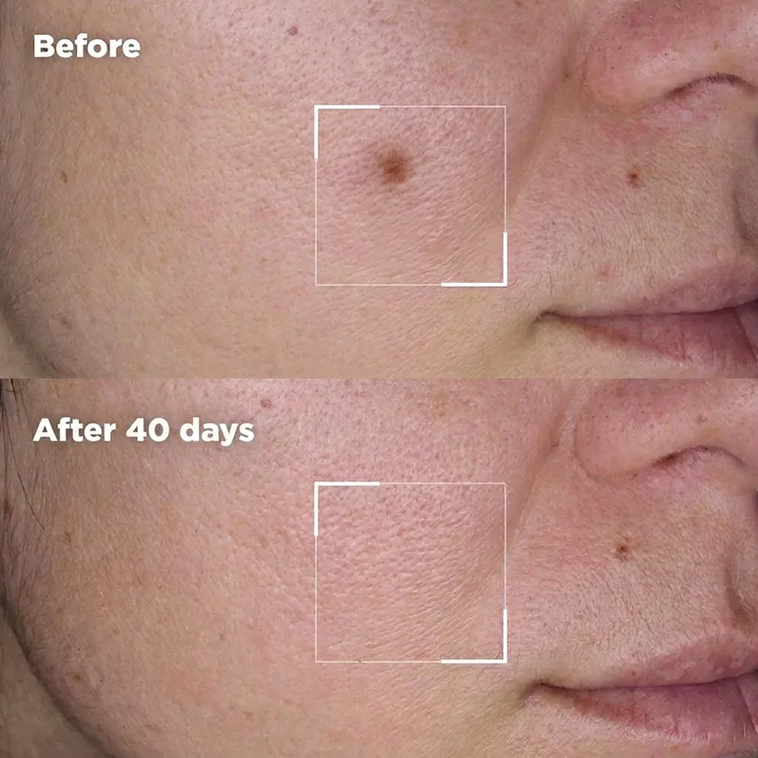 Before and after result