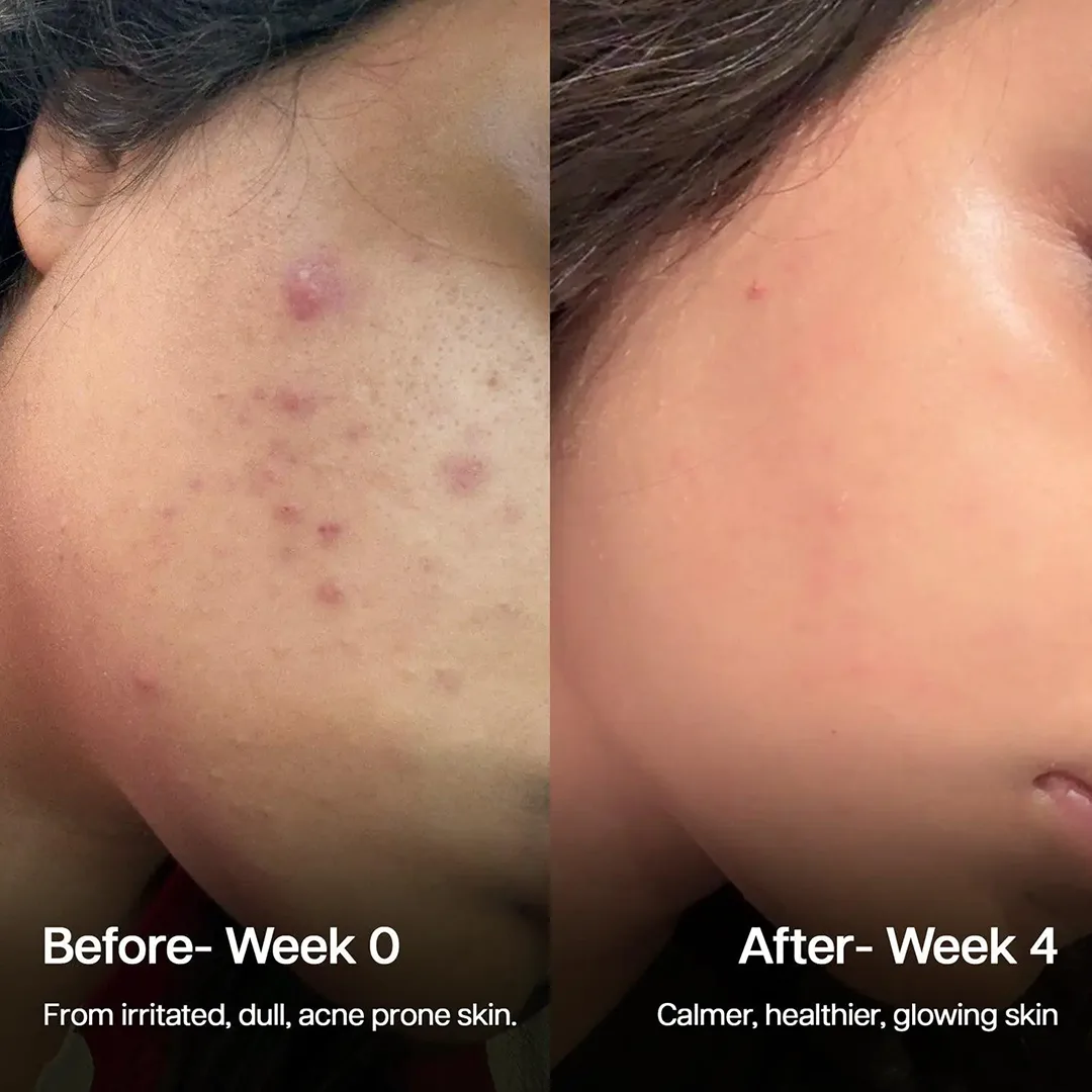 Before and after result 2